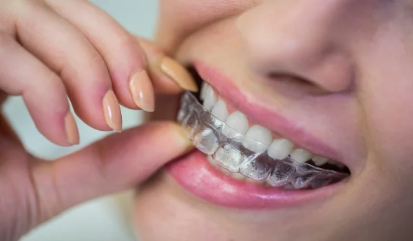 Invisalign Treatment in Mumbai 